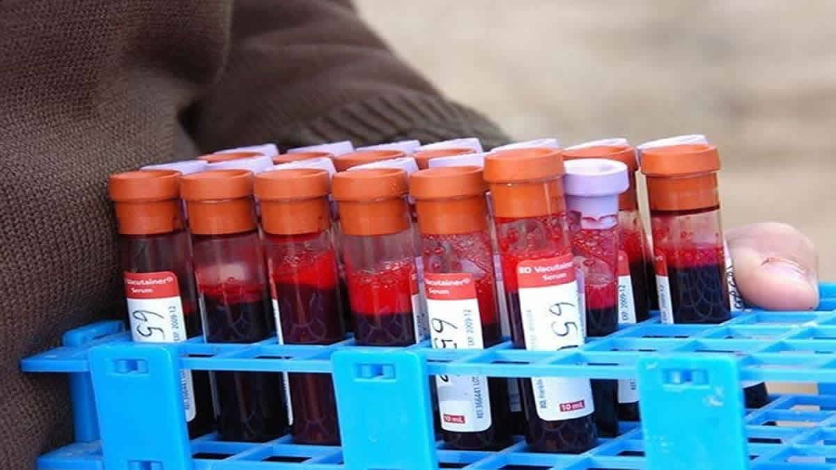 Mais De 6.000 Pessoas Infectadas Por Vazamento Na Fábrica De Vacinas Na China