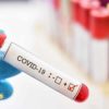 Epidemiologista Afirma Que Casos De Gripe Estão Sendo Contados Como COVID 19
