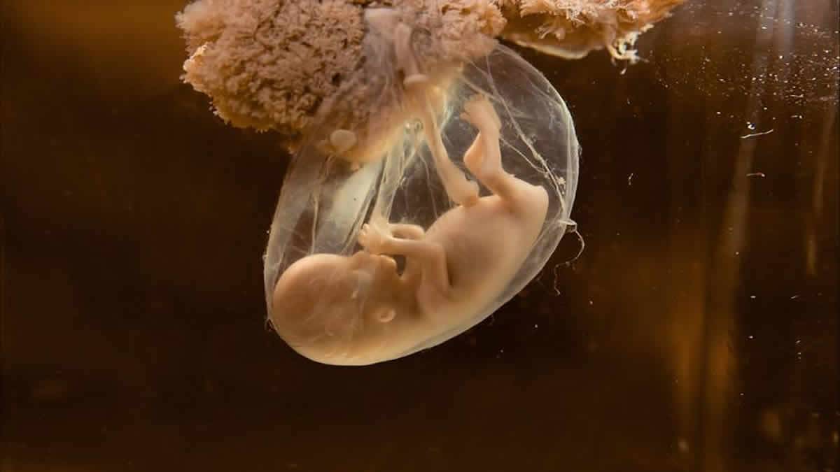 Bebês Foram Abortados Vivos, Colocados Em Geladeira Para Colher Linhagens De Células Utilizadas Em Algumas Vacinas