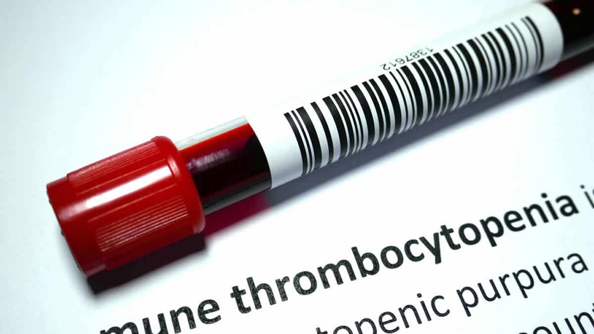 Dezenas De Pessoas Desenvolvem Doença Rara Do Sangue Após Tomar Vacinas Contra O Coronavírus – Relatórios