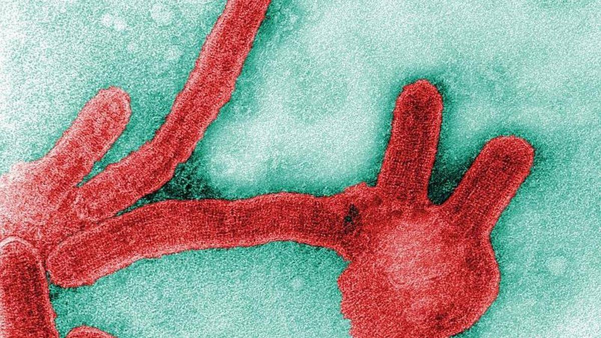 Vírus De Marburg Está Na Lista Da OMS De Possíveis Pandemias Após A Covid 19
