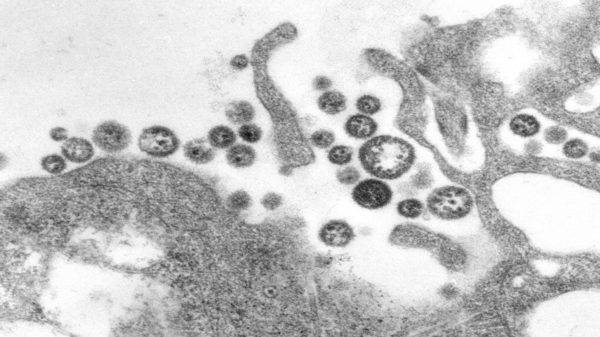 Imagem Microscópica Do Vírus Da Febre De Lassa Foto CDC CS Goldsmith