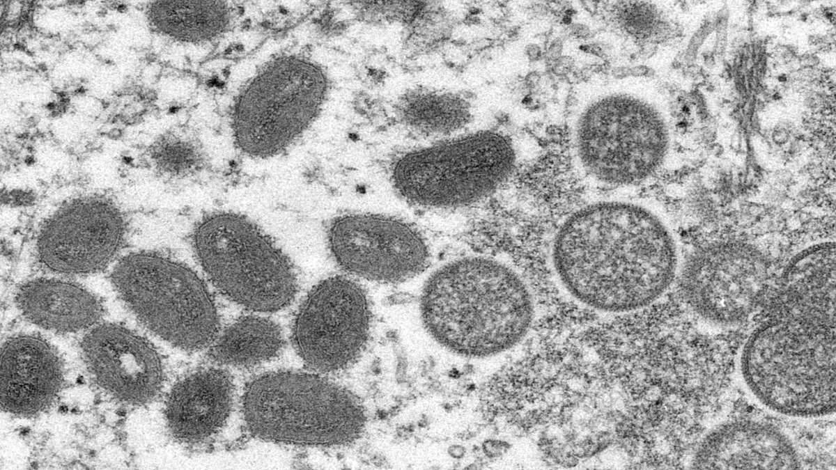 Vírus Da Varíola Dos Macacos Foto CDCCynthia S. Goldsmith, Russell Regnery