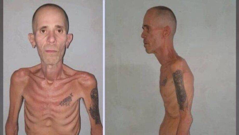 Prisioneiro político cubano libertado em estado semelhante a 'campo de concentração' gera revolta