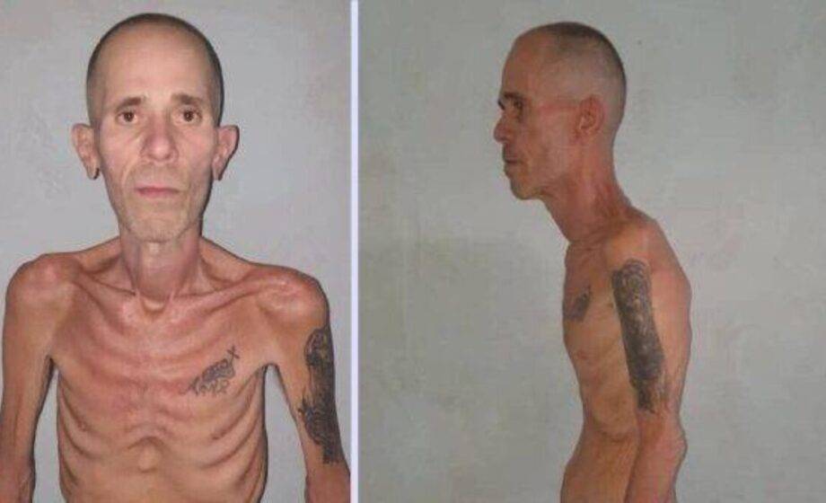 Prisioneiro político cubano libertado em estado semelhante a 'campo de concentração' gera revolta