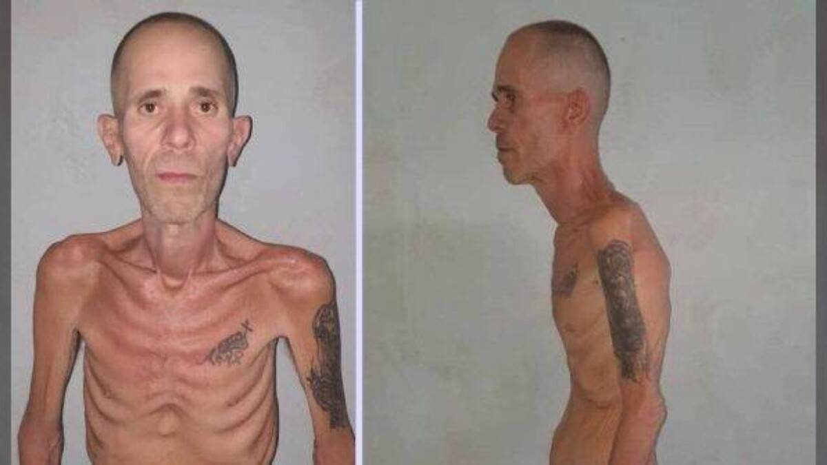 Prisioneiro político cubano libertado em estado semelhante a 'campo de concentração' gera revolta